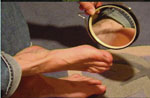 Learn self examination to detect Diabetes